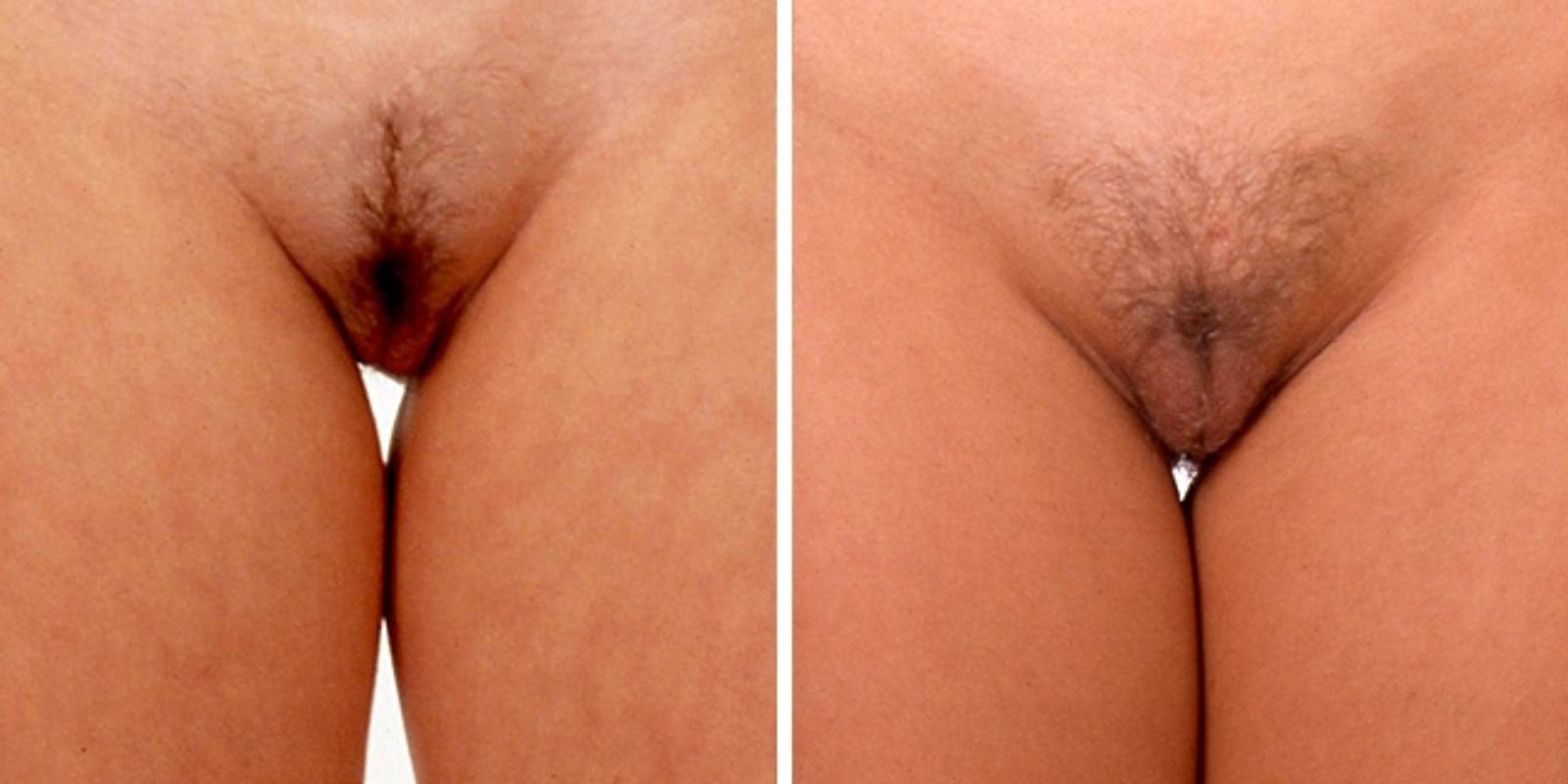 Muschis arten - Best adult videos and photos