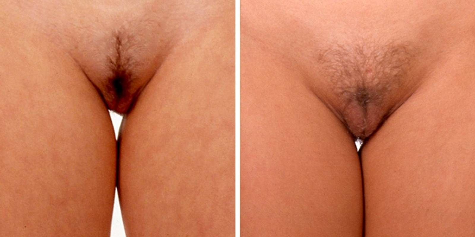 Vagina bilder vergleich nackt