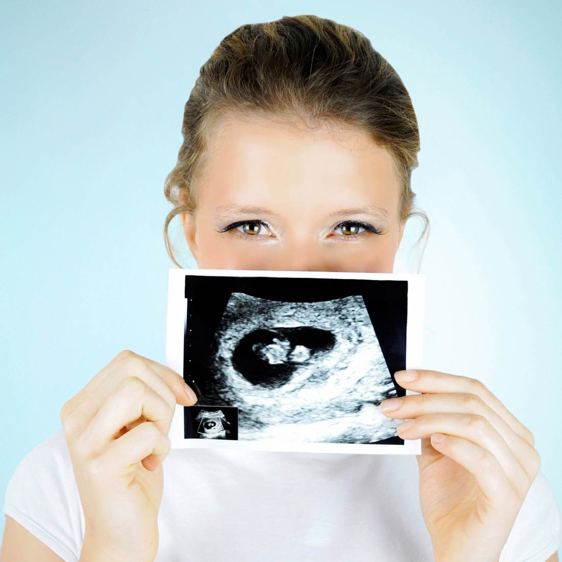 Das erste Bild vom Baby ist fast immer das Ultraschallbild!