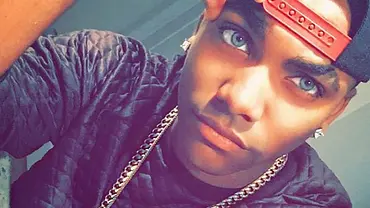 Youtuber: Ist DAS die krasseste Schönheits-OP aller Zeiten?! - Foto: Instagram Youtuber: Ist DAS die krasseste Schönheits-OP aller Zeiten?! - Foto: Instagram