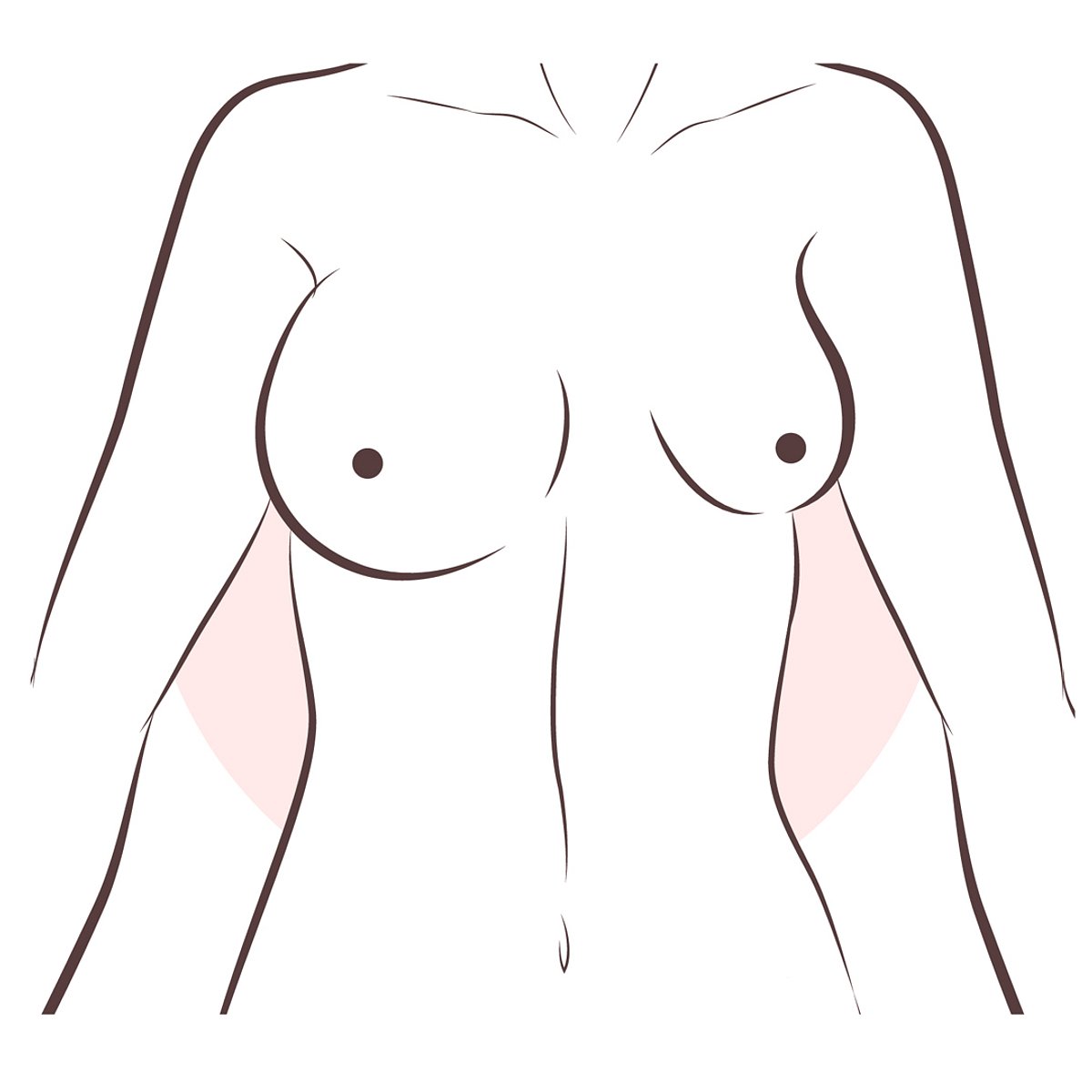 Brüste Form unterschiedlich