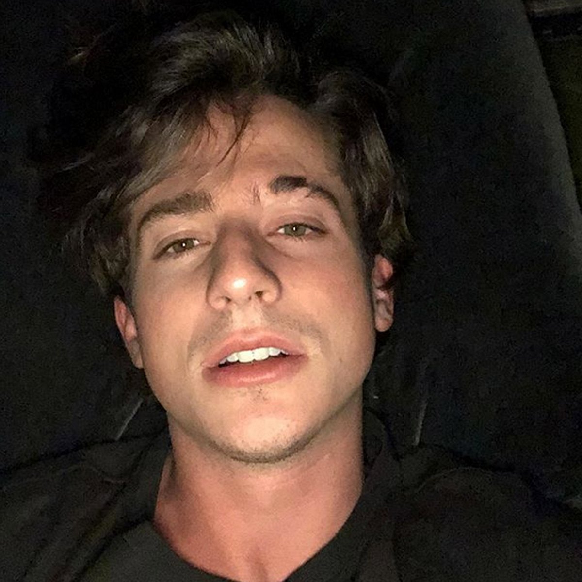 Charlie Puth hat sich unters Messer gelegt