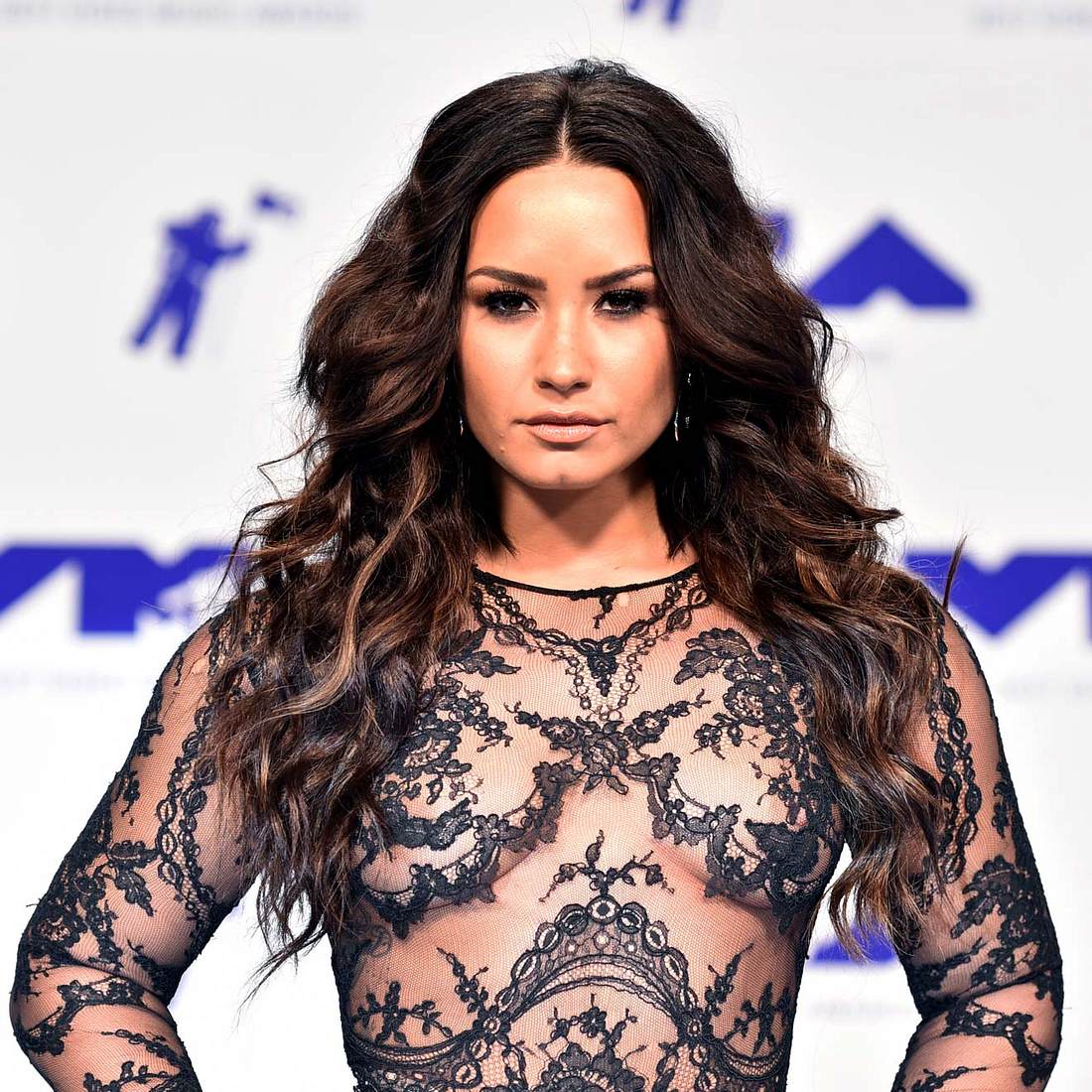 Demi Lovatos Zustand ist weiterhin kritisch