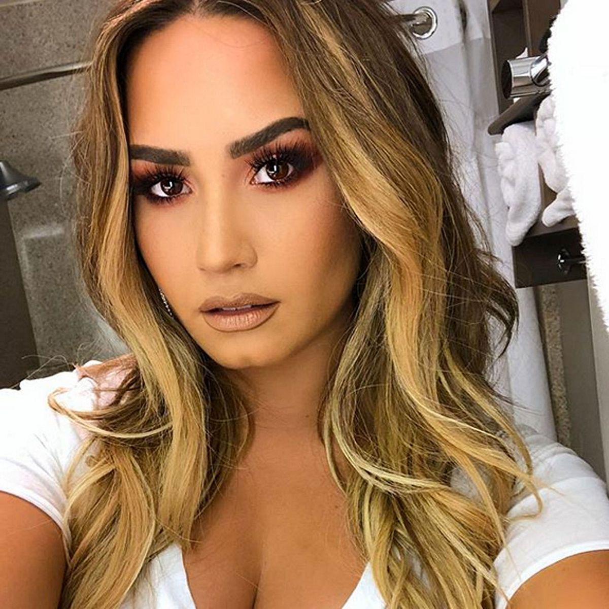 Der Zustand von Demi Lovato ist besorgniserregend