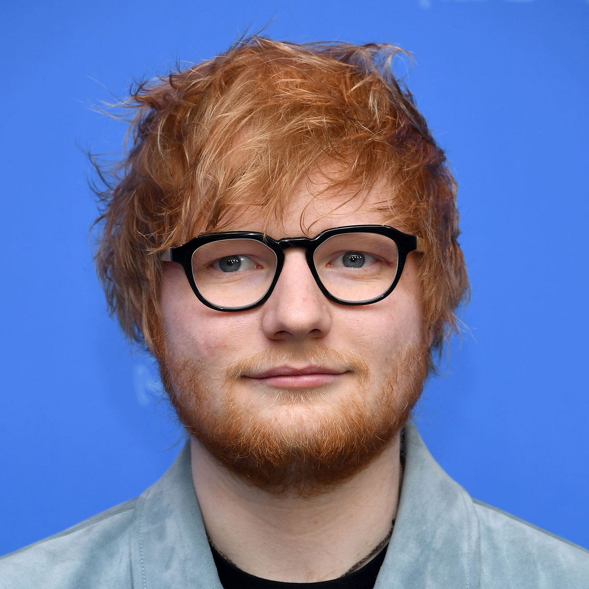 Ed Sheeran: Die Geschichte hinter seiner Narbe