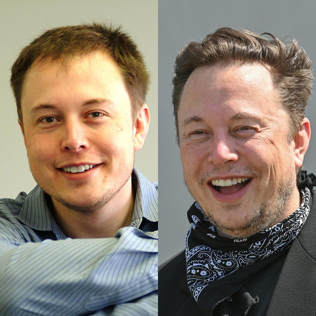Elon Musk Schönheits-OP: früher vs. Heute – „Beste Entscheidung!“ ?