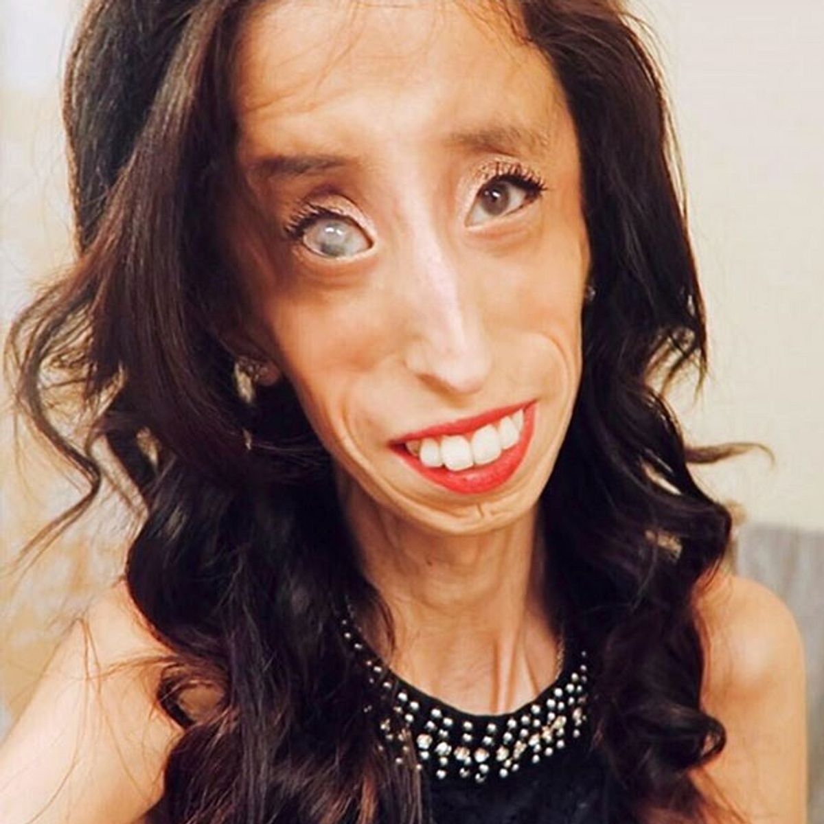 Lizzie Velasquez