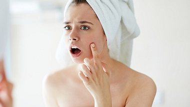 Pickel im Gesicht - Foto: iStock
