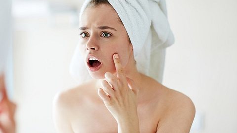 Pickel im Gesicht - Foto: iStock