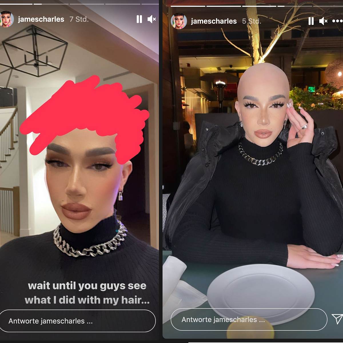 James Charles hat sich eine Glatze rasiert!