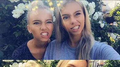 Lisa und Lena im Vorher-Nachher-Vergleich - Foto: Instagram/lisaandlena