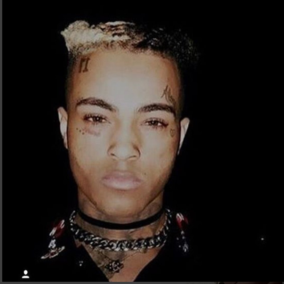 Die Klage gegen XXXTentacion wurde fallen gelassen.