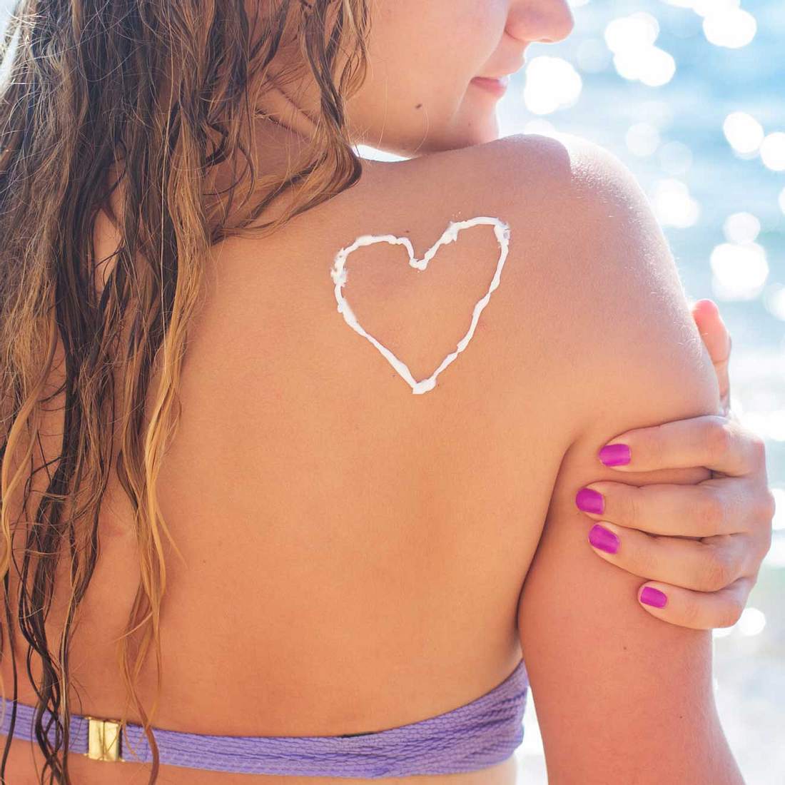 Sonnenbrand führt zu vorzeitiger Hautalterung!