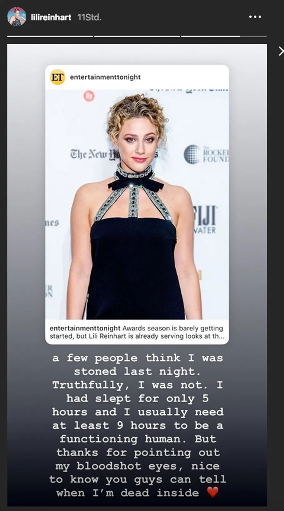 „Riverdale“-Star Lili Reinhart: Stoned auf dem roten Teppich?