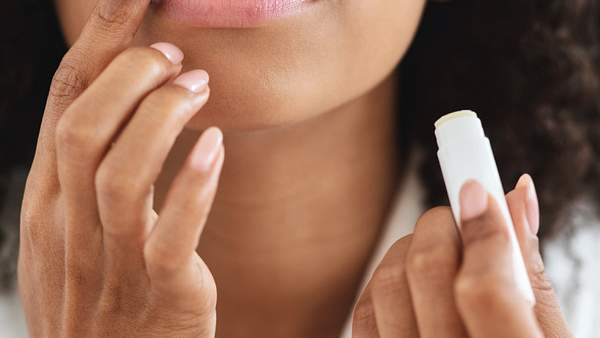 Trockene, spröde Lippen sind die Folge davon, wenn man seine Lippe nicht ausreichend pflegt. - Foto: Prostock-Studio / iStock