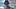 Schönheitsmakel der Stars Harry Styles - Foto: PR