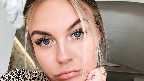 Sorge um Dagi Bee! - Foto: instagram @dagibee
