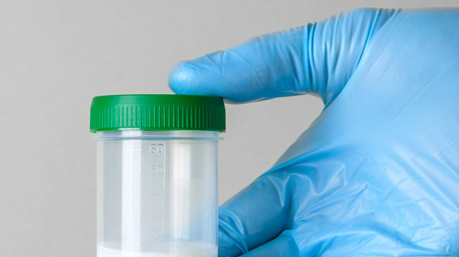 Warum ist sein Sperma plötzlich ganz durchsichtig? | BRAVO