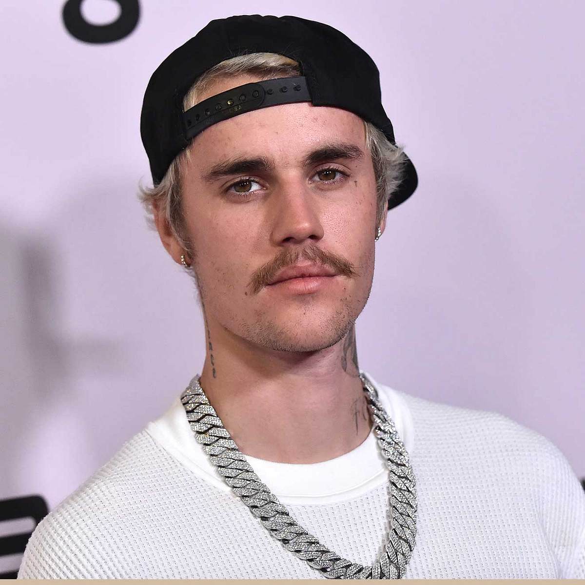 Stars und ihre Krankheiten Justin Bieber