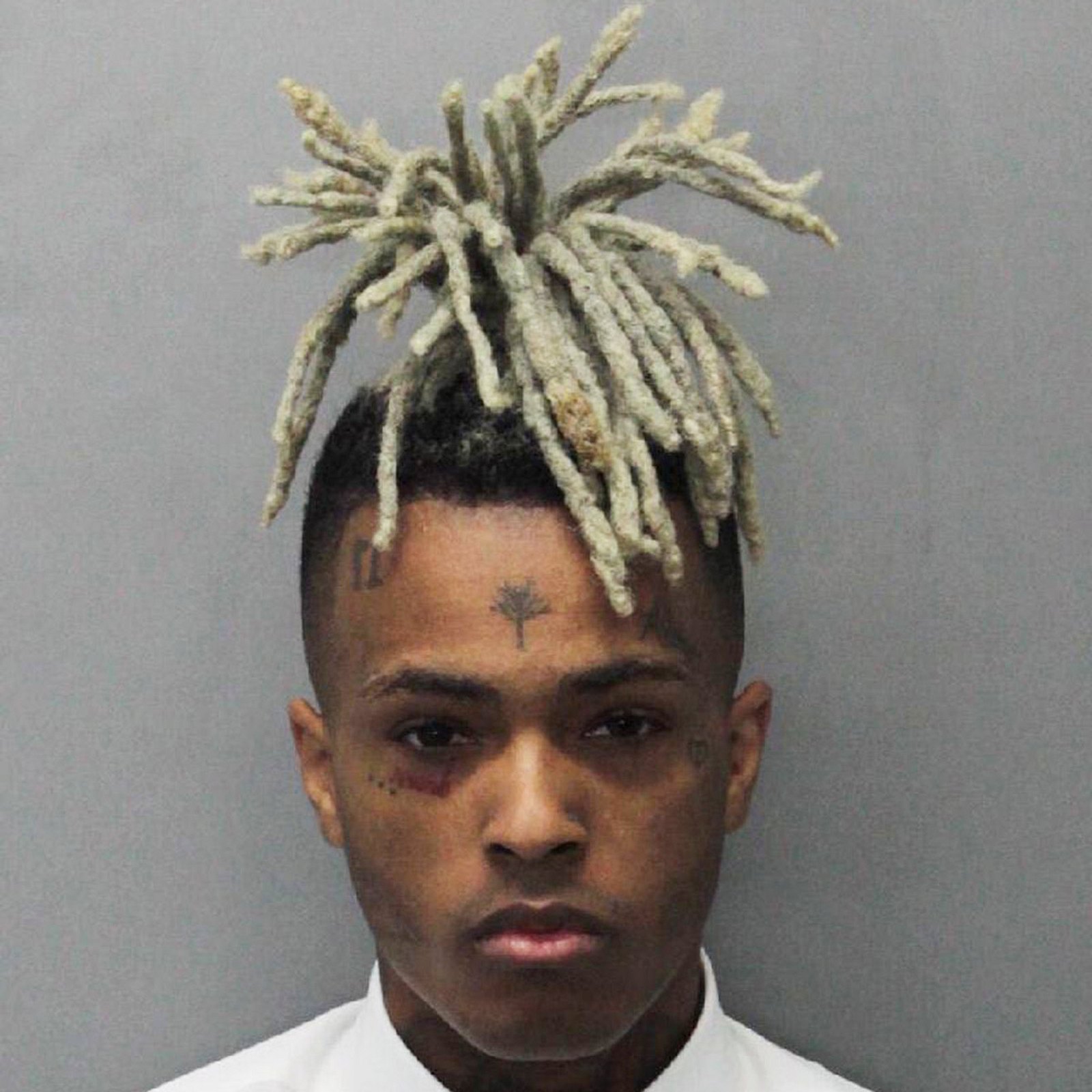 Xxxtentacion Mysteriöses Video Nach Dem Tod Aufgetaucht Bravo